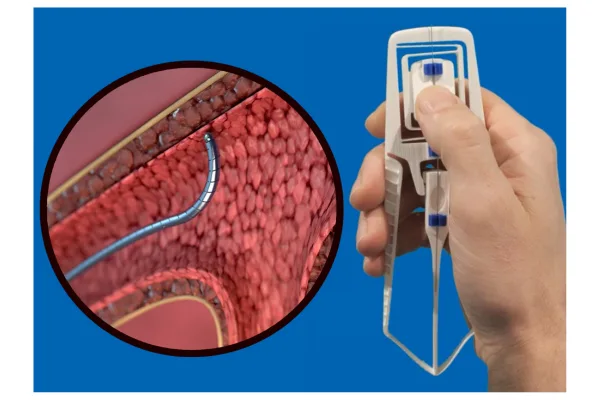 Steerable MEdical Devices 600x400.png