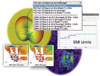 Agilent