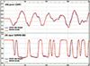 Mentor Graphics